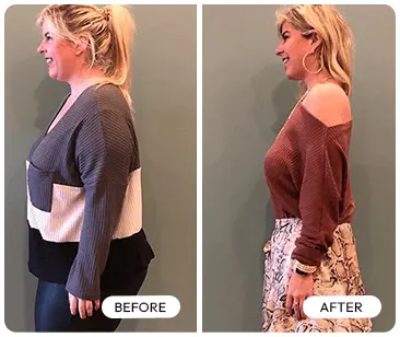Gelatine Sculpt Before and After Transformation 2