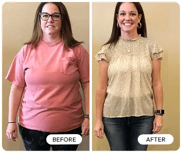 Gelatine Sculpt Before and After Transformation 3